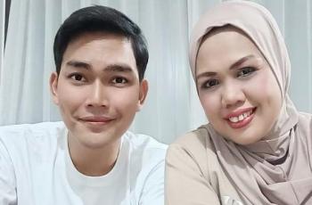 Elly Sugigi Blak-blakan Alasan Potong Gigi Tonggosnya
