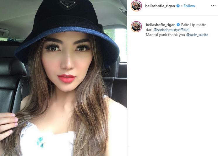 5 Artis Punya Alergi Tak Biasa, Ada yang Alergi Bedak Bayi - MataMata.com