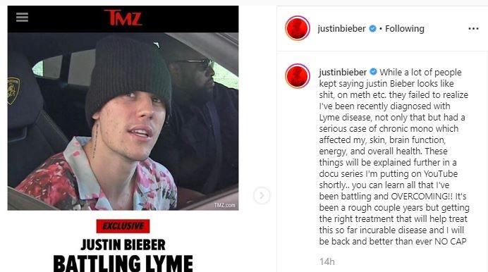 Justin Bieber. (Instagram/@justinbieber)