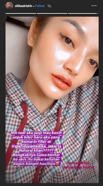 Siti Badriah. (Instagram/@sitibadriahh)