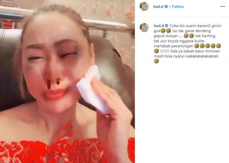Aksi kocak Inul Daratista dengan potret babak belur (Instagram/@inul.d)
