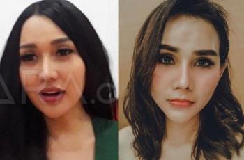 Sering Oplas, Mantan Manajer Sebut Lucinta Luna Lebih Laku sebelum Dipermak
