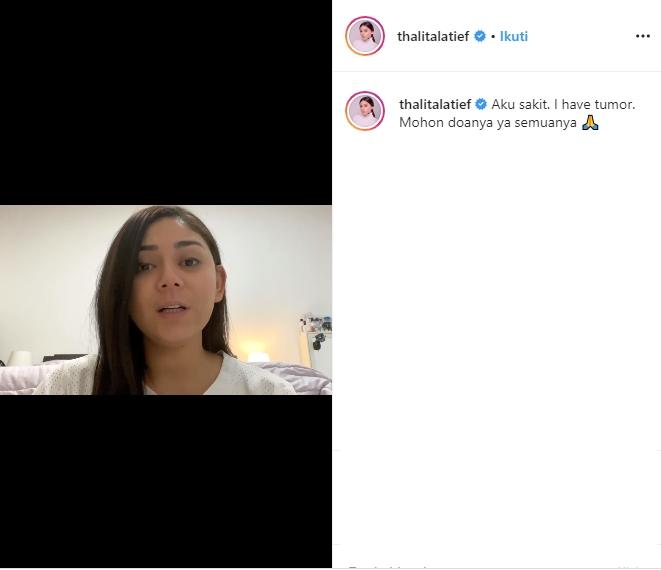 Thalita Latief ungkap idap tumor tiroid (Instagram/@thalitalatief)