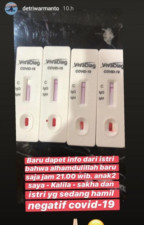 Detri Warmanto positif corona (Instagram/@detriwarmanto)