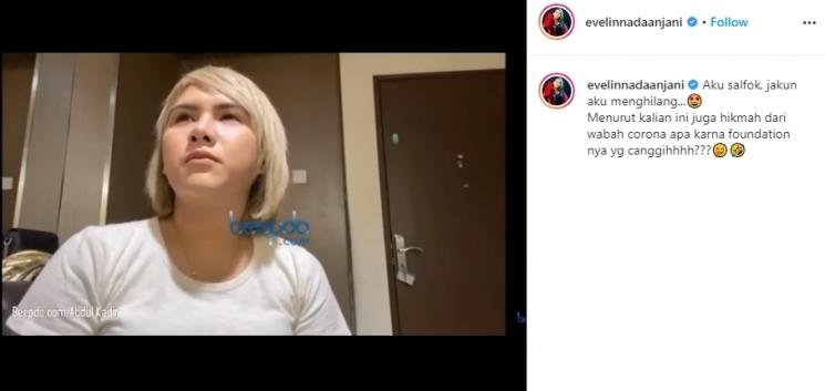 Evelin Nada Anjani Syok Jakunnya Menghilang (Instagram/@evelinnadaanjani)
