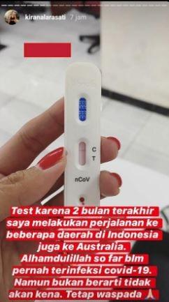 Kirana Larasati. (Instagram/@kiranalarasati)