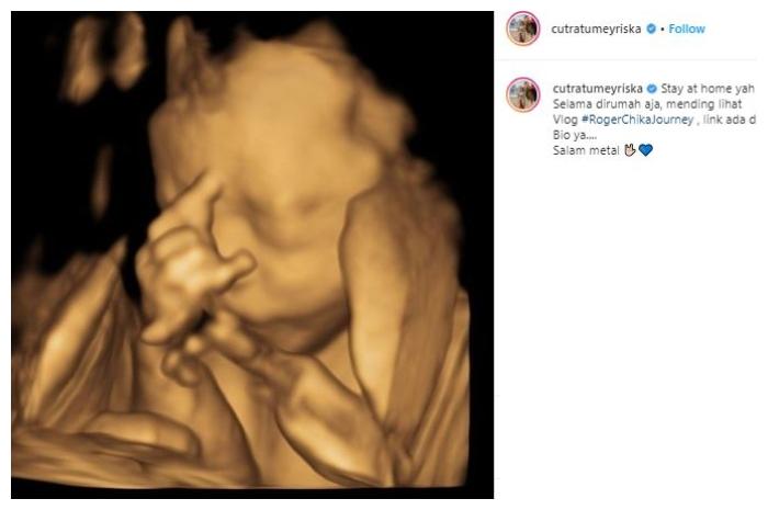 Tangan bayi Cut Meyriska. (Instagram/@cutratumeyriska)