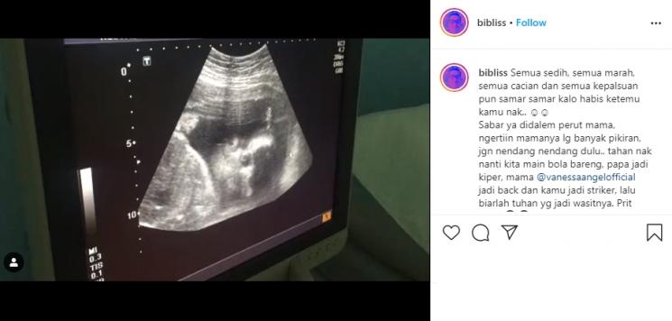 Bibi Ardiansyah unggah foto hasil USG Vanessa Angel. (Instagram/@bibliss)