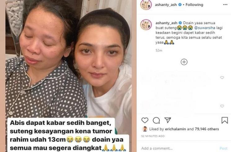 Pengasuh Arsy Hermansyah sakit tumor rahim (Instagram @ashanty_ash)