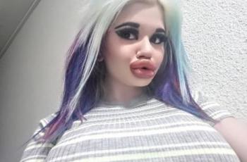 Cerita di Balik Gadis Pemilik Bibir Paling Dower di Dunia