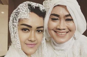Ibunda Julia Perez Gegar Otak usai Kecelakaan Ditabrak Motor