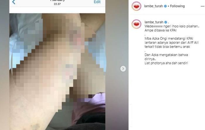 Aska Ongi kena KDRT. (Instagram/@lambe_turah)