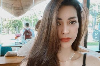 Sekujur Tubuh Biru Lebam, 4 Potret Aska Ongi Ngaku Kena KDRT Aliff Alli