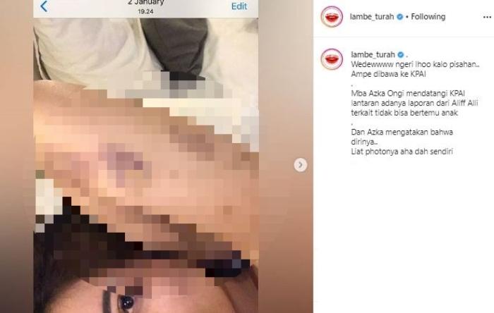Aska Ongi kena KDRT. (Instagram/@lambe_turah)
