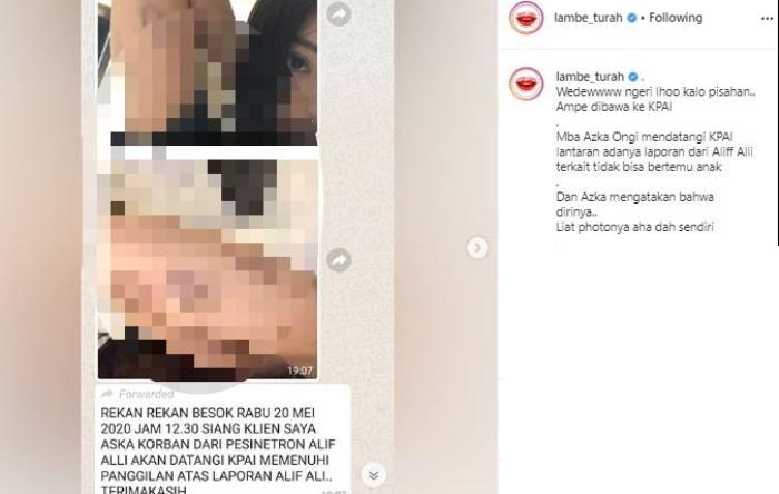 Aska Ongi kena KDRT. (Instagram/@lambe_turah)