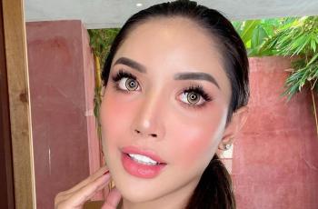 Dibilang Balik Kayak Cowok, 5 Potret Terbaru Millendaru Pasca Filler Bibir