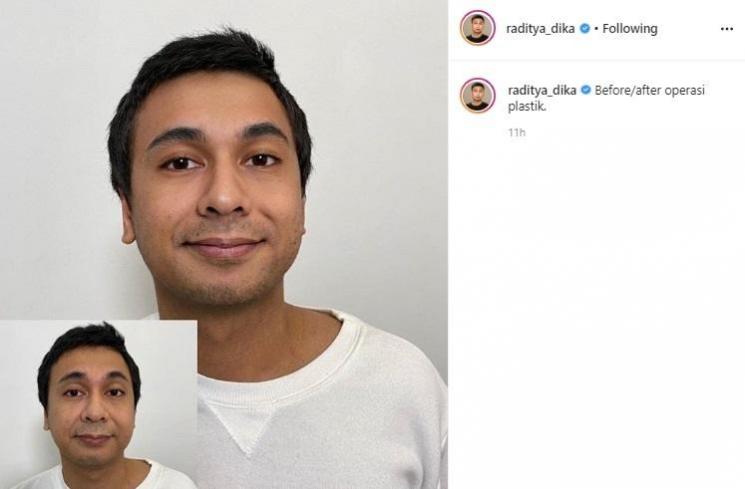 Seleb ikut Oplas Challenge. (Instagram)