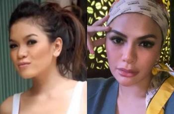 Oplas Hidung, Begini Perubahan Penampilan Before dan After 5 Seleb Cantik Ini