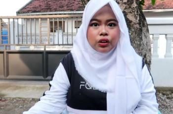 Giginya Sering Jadi Bahan Cibiran, Ini Alasan Kekeyi Tak Mau Pasang Behel