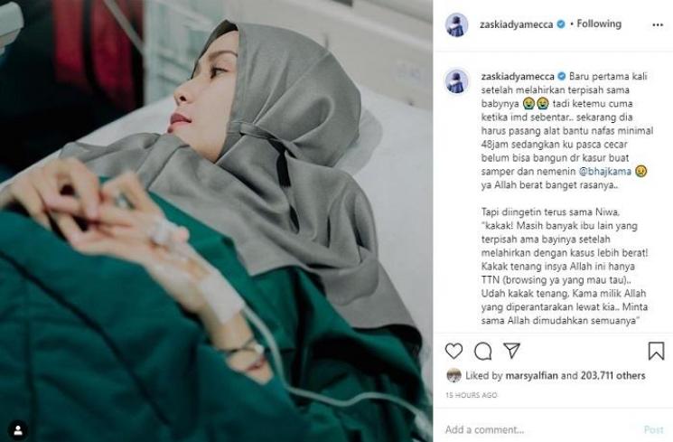 Bayi Zaskia Adya Mecca dipasangi alat bantu napas (Instagram @zaskiadyamecca)