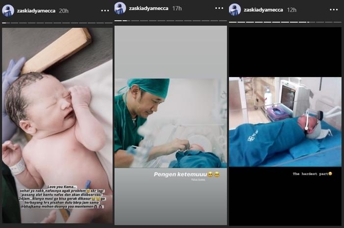 Bayi Zaskia Adya Mecca dipasangi alat bantu napas (Instagram @zaskiadyamecca)