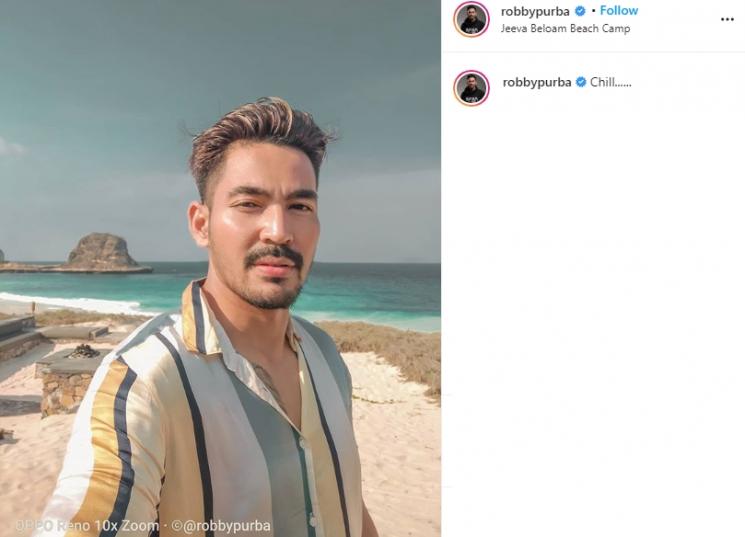 Seleb yang lakukan perawatan botox. (Instagram/@robbypurba)