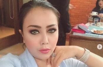 Artis Rency Milano Diduga Jadi Korban Malpraktik, Dagunya Keluar Nanah