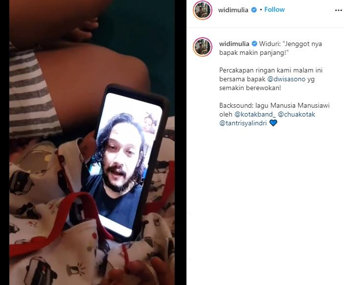 Potret baru Dwi Sasono direhabilitasi. (Instagram/@widimulia)