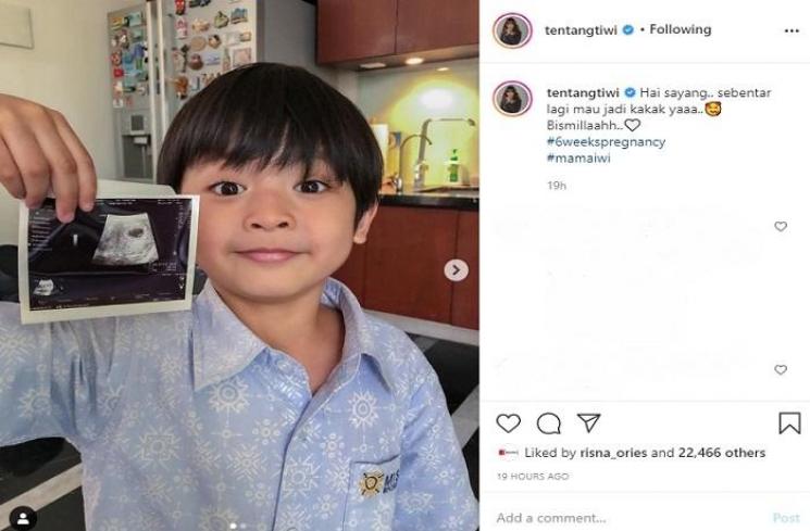 Tiwi eks T2 (Instagram @tentangtiwi)