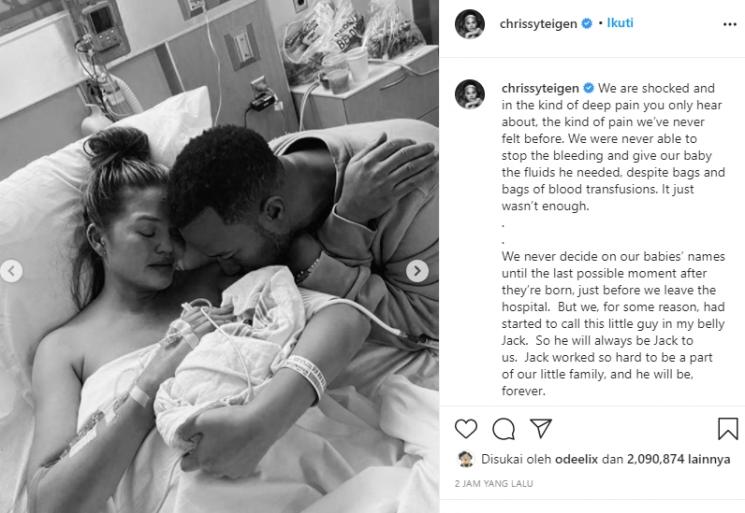 Chrissy Teigen keguguran (Instagram/@chrissyteigen)