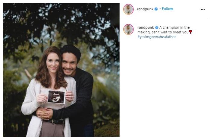 Randy Pangalila dan istri pamer potret mesra dan USG. (Instagram/@randpunk)