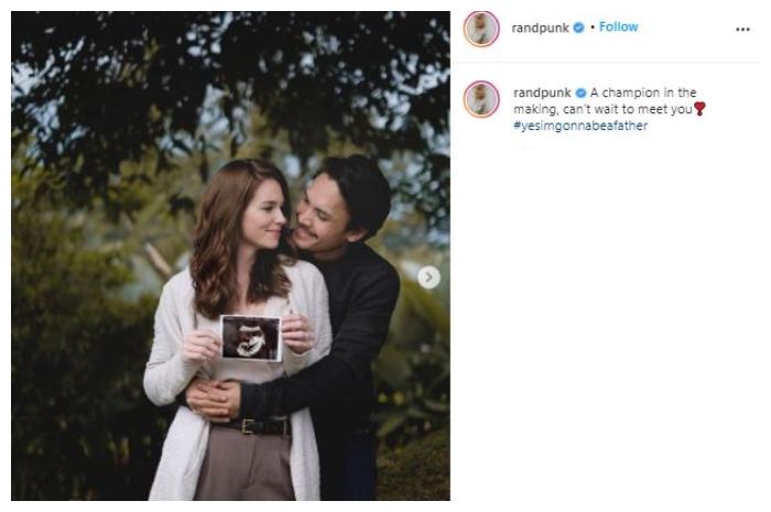 Randy Pangalila dan istri pamer potret mesra dan USG. (Instagram/@randpunk)