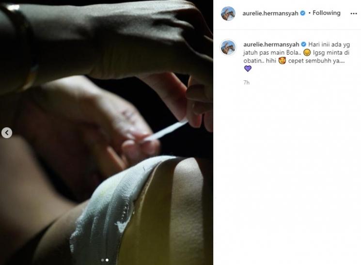 Aurel Hermansyah obati luka Atta Halilintar. (Instagram/@aurelie.hermansyah)