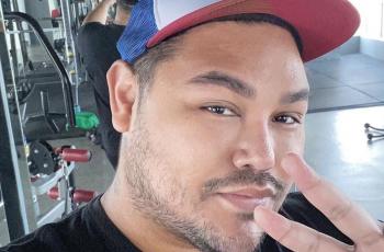 Hidung Ivan Gunawan Pernah Busuk Gara-gara Tanam Benang