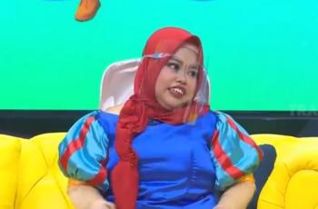 Kekeyi Ogah Pasang Behel: Gigiku Langka, Aku Bangga!