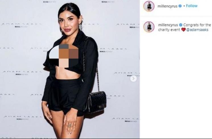 Potret terbaru Millendaru pasca filler. (Instagram/@millencyrus)