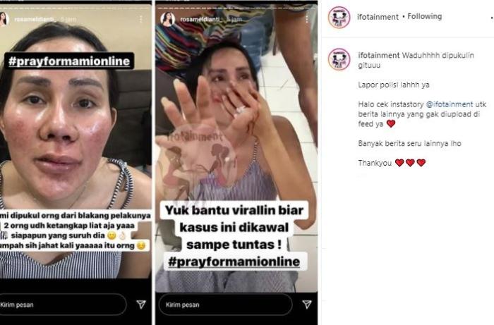 Isa Zaga ngaku dipukuli orang. (Instagram/@ifotainment)