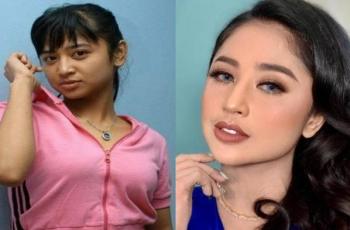 Bantah Operasi Plastik, Dewi Perssik Ungkap Rahasia Perubahan Drastisnya