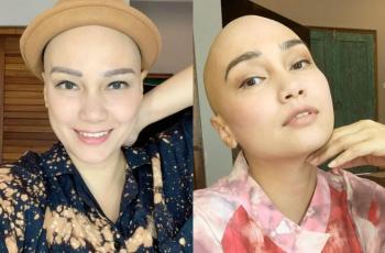 Cerita Haru Feby Febiola Melawan Kanker: Sebuah Perjalanan yang Tidak Mudah