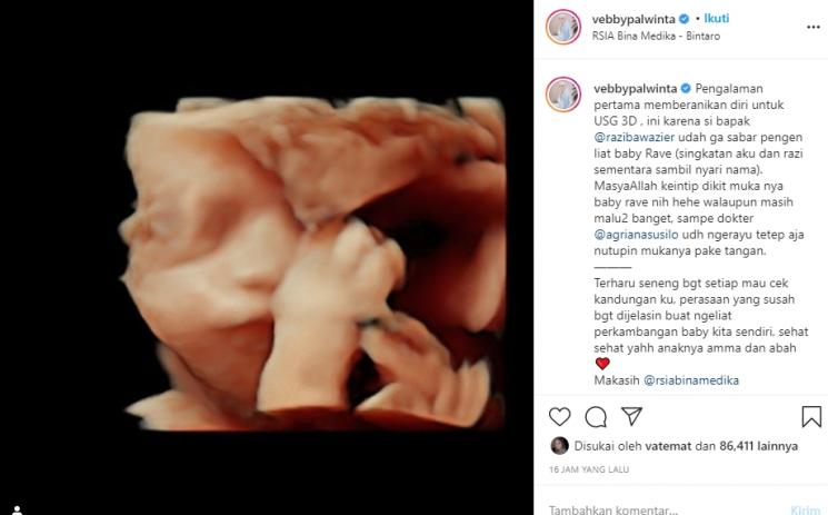 Vebby Palwinta dan Razi Bawazier (Instagram/@vebbypalwinta)
