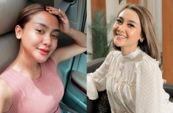 Cita Citata Pamer Kulit Baru, Kok Bagus yang Dulu?