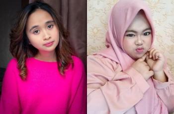 Gritte Agatha Pakai Kostum Pentol Kekeyi: Kalau yang Pakai Itte Jadi Imut Banget