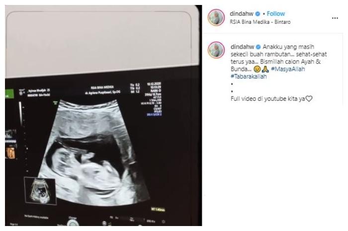 Dinda Hauw. (Instagram/@dindahw)