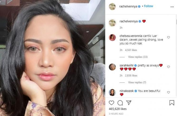 Rachel Vennya dituduh lepas hijab (Instagram.com/rachelvennya)