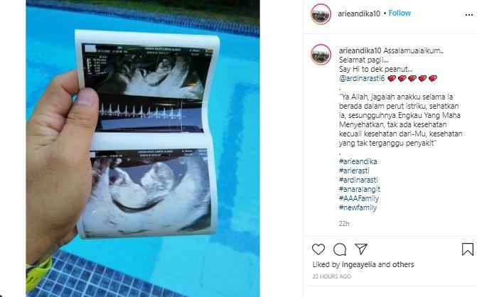 Ardina Rasti hamil anak kedua. (Instagram/@ariandika10)