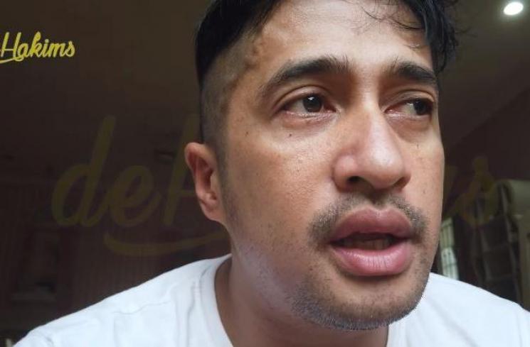 Irfan Hakim positif Covid 19. (Youtube/deHakims)