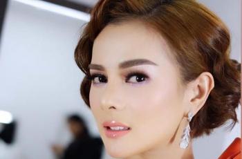 Isu Astrid Tiar Operasi Plastik Ramai Dibahas Lagi, Foto Ini Penyebabnya