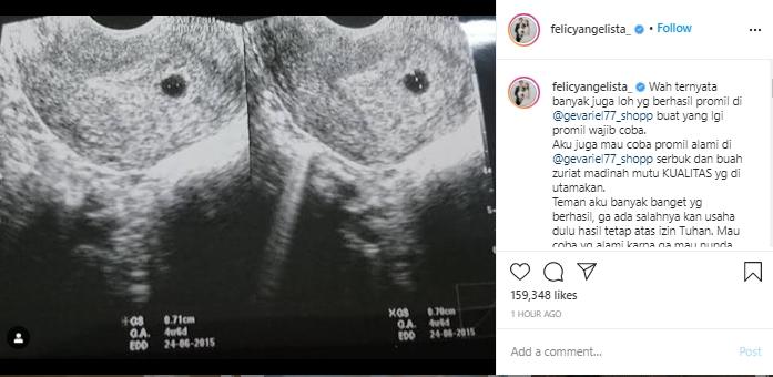 Postingan Felicya Angelista (Instagram.com)