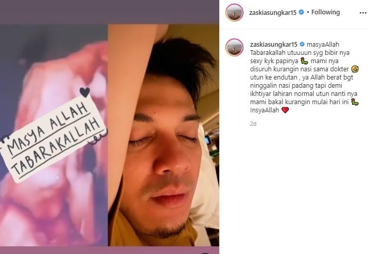 Foto USG jabang bayi Zaskia Sungkar dan Irwansyah. (Instagram/@zaskiasungkar15)