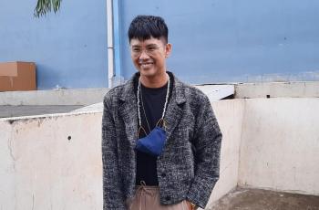 Ricky Cuaca Oplas Hidung, Penampilan Terbarunya Disebut Mirip Roy Kiyoshi